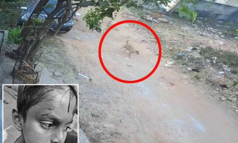 बिलासपुर-में-pm-श्री-स्कूल-के-अंदर-कुत्ते-ने-पहली-कक्षा-के-बच्चे-को-नोचा,-बचाने-दौड़ी-टीचर-पर-भी-किया-हमला