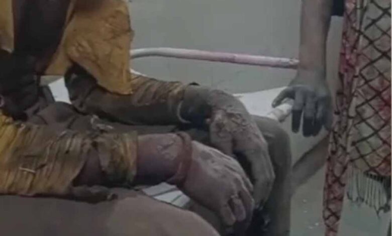 कटनी-में-पुरानी-रंजिश-पर-बमबाजी,-9-लोग-घायल;-इलाके-में-भारी-पुलिस-बल-तैनात