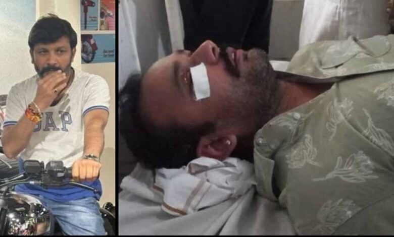 सतना-में-रोड-टेंडर-पर-बवाल:-हवाई-फायरिंग-के-बाद-पिस्टल-की-बट-से-हमला,-cctv-खंगाल-रही-पुलिस